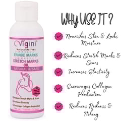 Vigini Stretch Marks Scar removal cream Oil contain 100% Natural Actives, Bio Oils a mark remover in during or after Pregancy Delievery for women,remove hyper pigmentation uneven skin tone(200G)