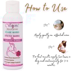 Vigini Stretch Marks Scar removal cream Oil contain 100% Natural Actives, Bio Oils a mark remover in during or after Pregancy Delievery for women,remove hyper pigmentation uneven skin tone(200G)