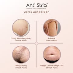 ANTI STRIA™ Best Stretch Marks Removal Cream for Pregnancy, PCOS, Weight Gain | For Women, Men, Teenagers | Prevent, Fade, Reduce Stretch (Pack of 1)